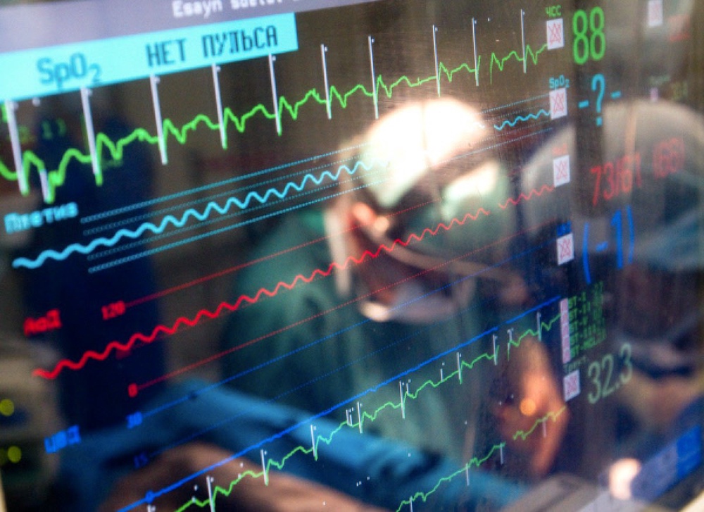 Монитор, показывающий параметры жизнедеятельности пациента во время операции. Фото ©РИА Новости