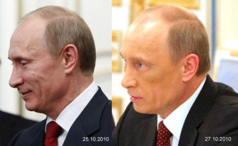 Владимир Путин после предполагаемой инъекции ботокса (слева). Фото с сайта segodnya.uа