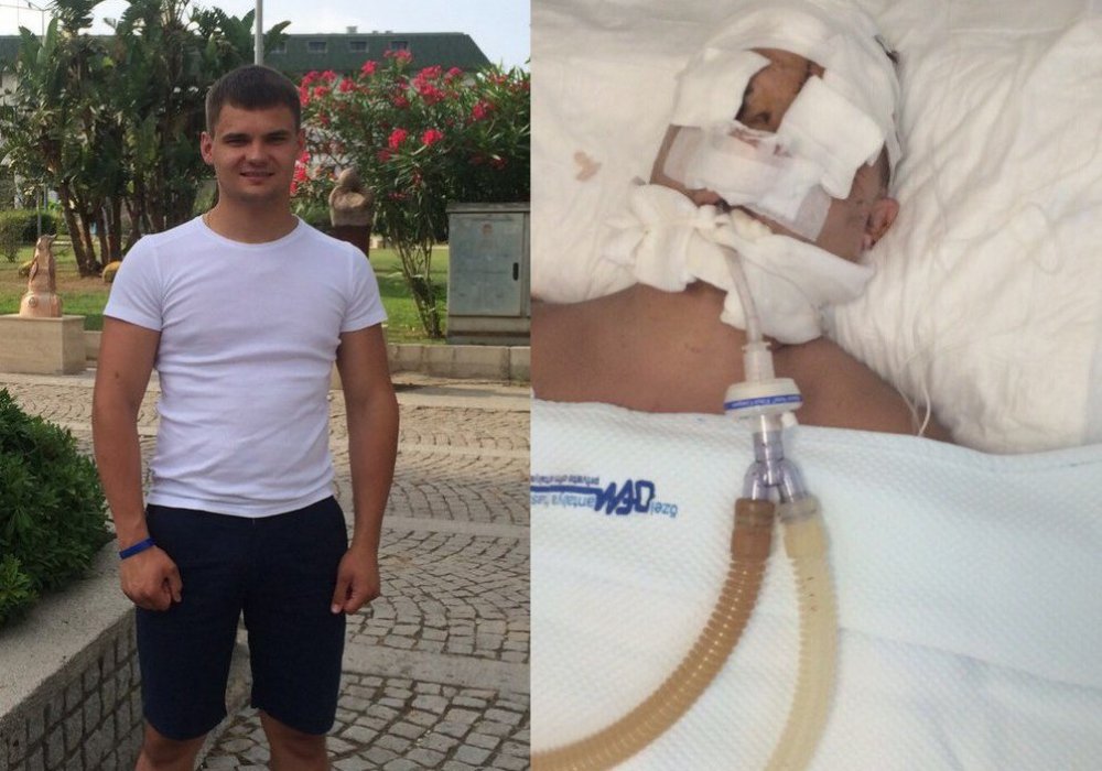21-летний Константин Иванов перенес сложную операцию на голову. © vk.com