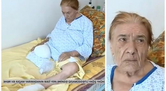 В Баку пациентке ампутировали здоровую ногу вместо больной
