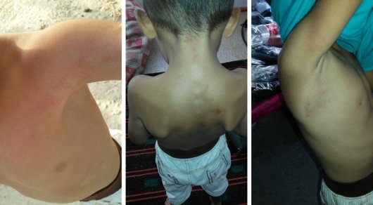 В ЮКО воспитателя детсада родители обвинили в избиении 5-летнего ребенка
