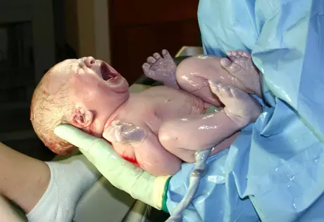 Украинка родила первенца в 66 лет