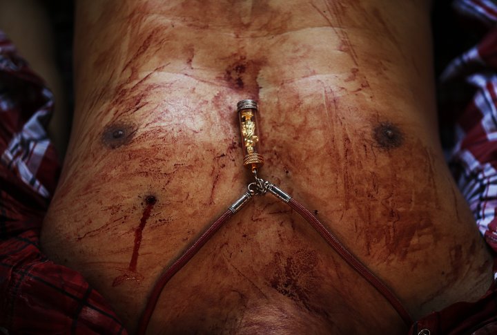 Пулевое отверствие на теле убитого демонстранта. ©REUTERS