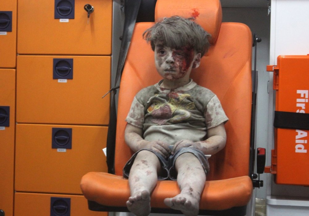 <p>Пятилетний Омран Дакниш был среди пострадавших при авиаударе по жилому дому в Алеппо, где ведут бои правительственные силы и повстанцы. Оппозиционные активисты обвиняют в обстреле режим Башара Асада.</p>