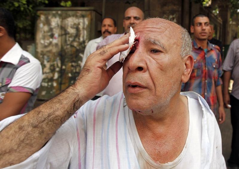 Местный житель, раненый в столкновениях со сторонниками свергнутого президента Египта Мохаммеда Мурси в центре Каира 13 августа 2013 года. Фото ©REUTERS