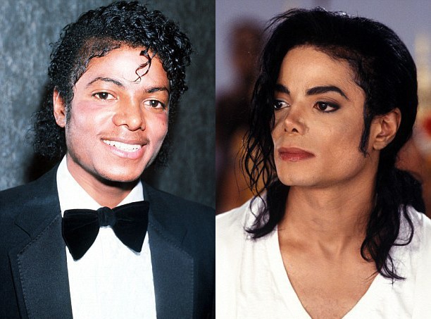 СМИ назвали причину смены цвета кожи Майкла Джексона