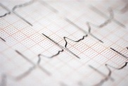 Алматинские кардиологи прооперировали 95-летнюю женщину