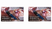 Правительство Казахстана утвердило формат предупреждения о вреде курения