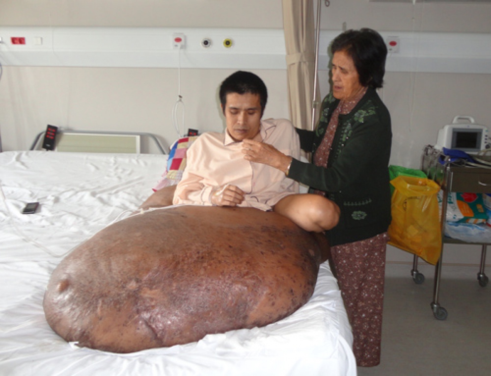 Нгуен Зуй Хай перед операцией. Фото с сайта thanhnien.com.vn