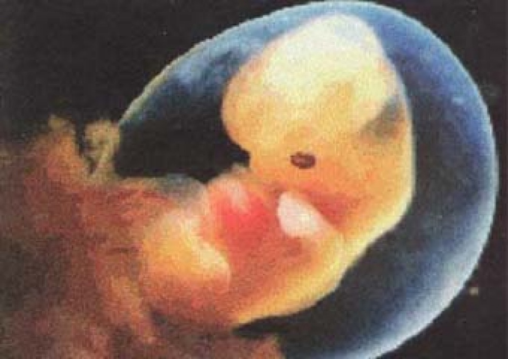 Человеческий эмбрион. Фото из архива Tengrinews.kz