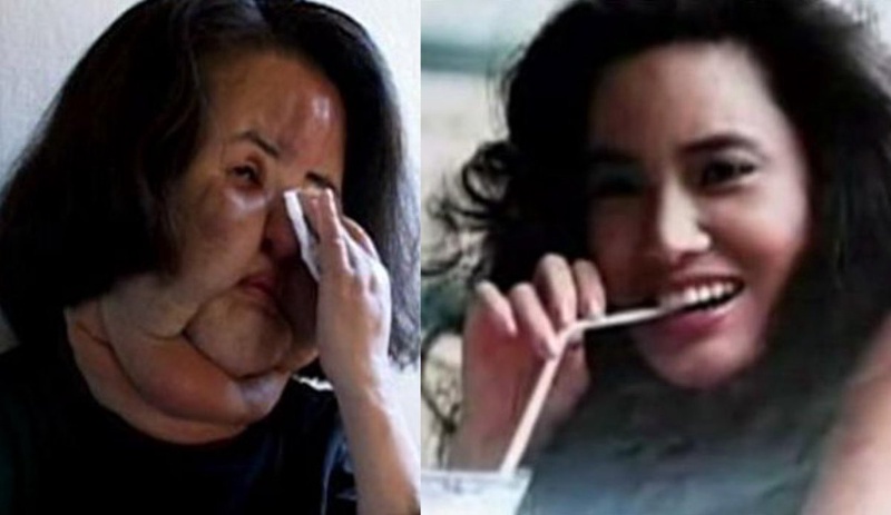 Бывшая модель Хан Миоку "до и после". Фотоколлаж с сайта mundoincreible.com
