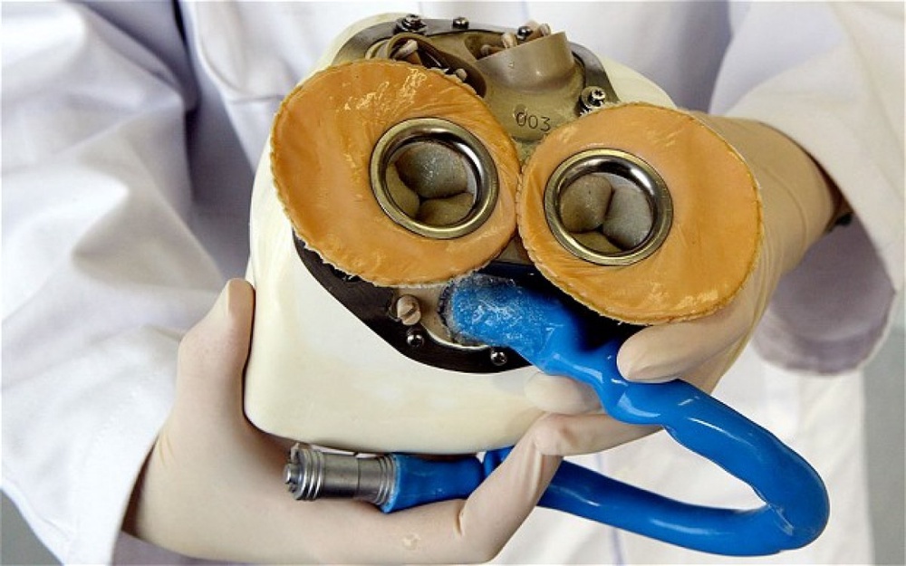 Прототип первого в мире искусственного сердца. Фото с сайта telegraph.co.uk