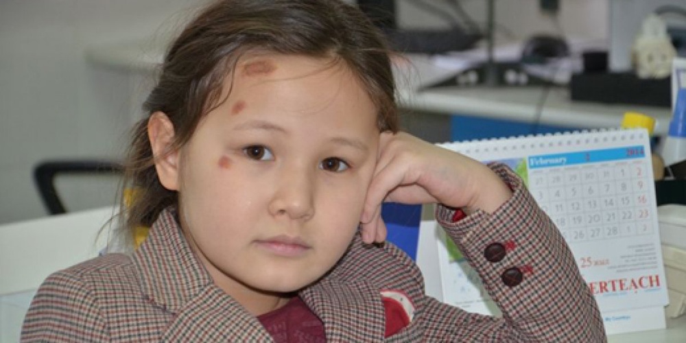 7-летняя Алия получила травмы головы и груди. Фото "Ак Жайык". 