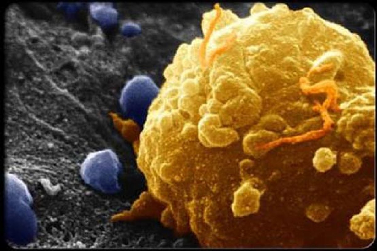 антиген раковых опухолей