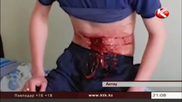 Пациент больницы в Актау устроил кровавое шоу
