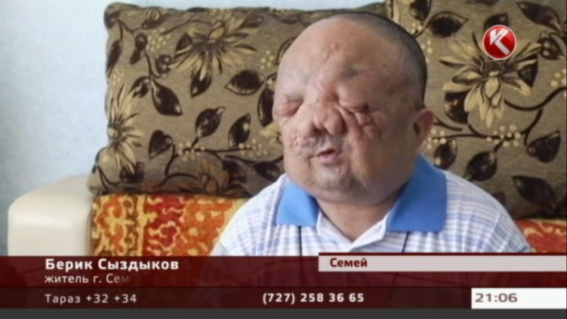 Берик Сыздыков после операции в Мадриде. Кадр телеканала КТК