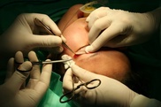 Сложные болезни глаз будут лечить европейские специалисты в Астане