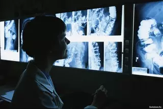 Свыше 2 тысяч казахстанцев заболели раком в 2014 году