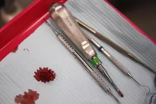 Женщина отсудила 80 тысяч тенге у стоматологов в Алматы за вырванный зуб