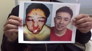 В Сети появилось видео с избитым Алиби Жумагуловым