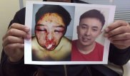 Адвокат Алиби Жумагулова рассказала о полученных им при избиении травмах