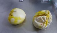 Наркокурьершу с кокаиновой грудью задержали в Колумбии