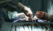 Разрыв аорты у китайского хирурга не помешал ему завершить операцию
