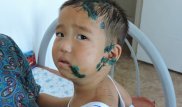 Собака содрала скальп с 3-летнего мальчика в Мангистауской области