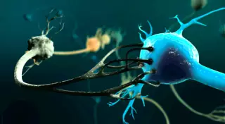 Первые случаи заражения болезнью Альцгеймера выявили в Великобритании