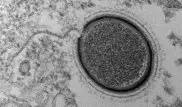 Ученые "воскресят" 30000-летний гигантский вирус