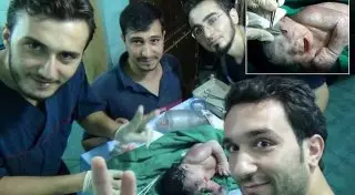 В Сирии родился ребенок с осколком ракеты в голове