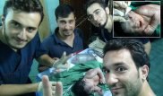 В Сирии родился ребенок с осколком ракеты в голове
