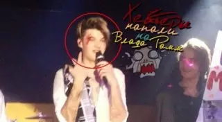 В Минске солисту группы MBAND разбили бровь картошкой