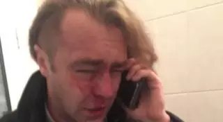 Экс-депутата Рады избил любовник жены