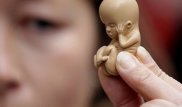 Женщинам в Абхазии запретили делать аборты