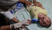 Число зараженных вирусом Зика в Колумбии превысило 51 тысячу человек