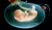 В Нидерландах разрешат выращивать человеческие эмбрионы для научных исследований