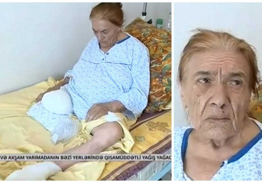 87-летней Тарлане Алиевой ампутировали здоровую ногу вместо больной. © anspress.com
