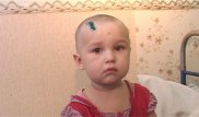 Еще одного ребенка покусала собака в Костанайской области