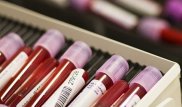 WADA приостановило деятельность антидопинговой лаборатории в Алматы
