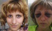 Жительница Костанайской области обвиняет бывшего мужа в жестоком избиении