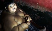 В 10 лет 192 килограмма: в Индонезии живет самый толстый ребенок в мире