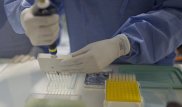 Вспышка сибирской язвы в Алматинской области ликвидирована