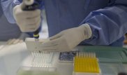 Число людей с подозрением на сибирскую язву увеличилось в Павлодарской области
