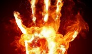 Поджегший 8-летнего сына мужчина умер в больнице Балхаша