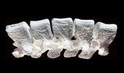Ученые научились "ремонтировать" переломы костей при помощи 3D-печати