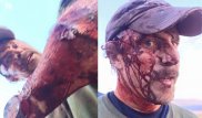 Американец показал страшные раны, нанесенные медведем гризли