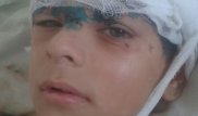 120 швов наложили на голову школьника после ДТП в Карагандинской области