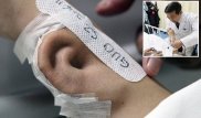 Китайский хирург вырастил на руке у пациента ухо, потерянное в жуткой аварии