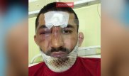 Расулу Мирзаеву пытались сломать ноги и задушить его цепью